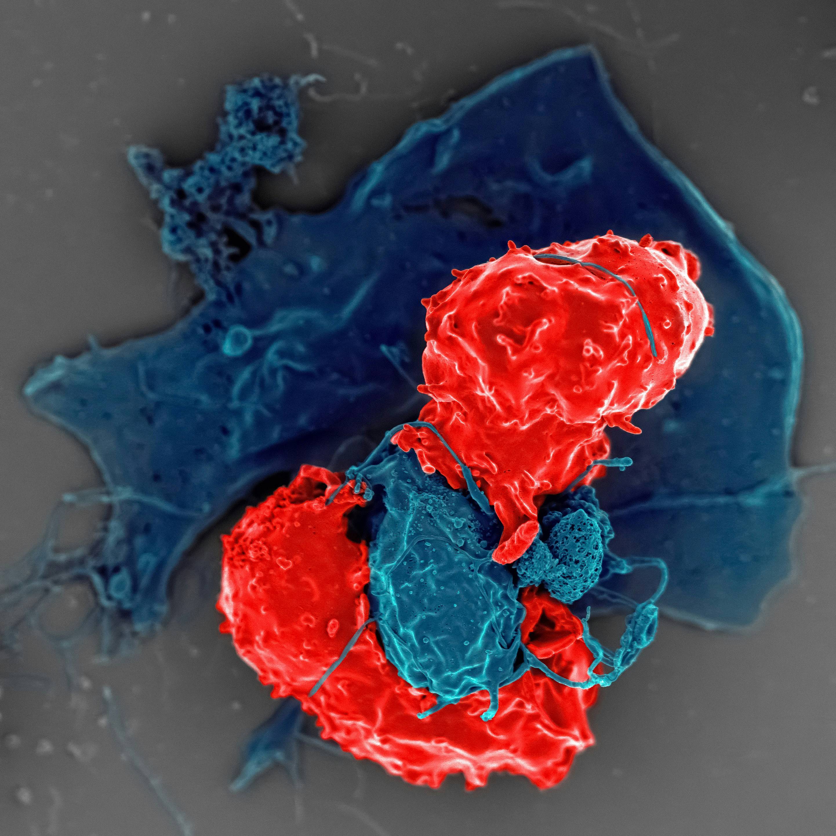 CAR-T Cell