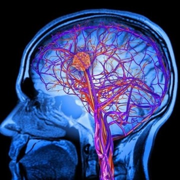 CAR-T for Glioblastoma